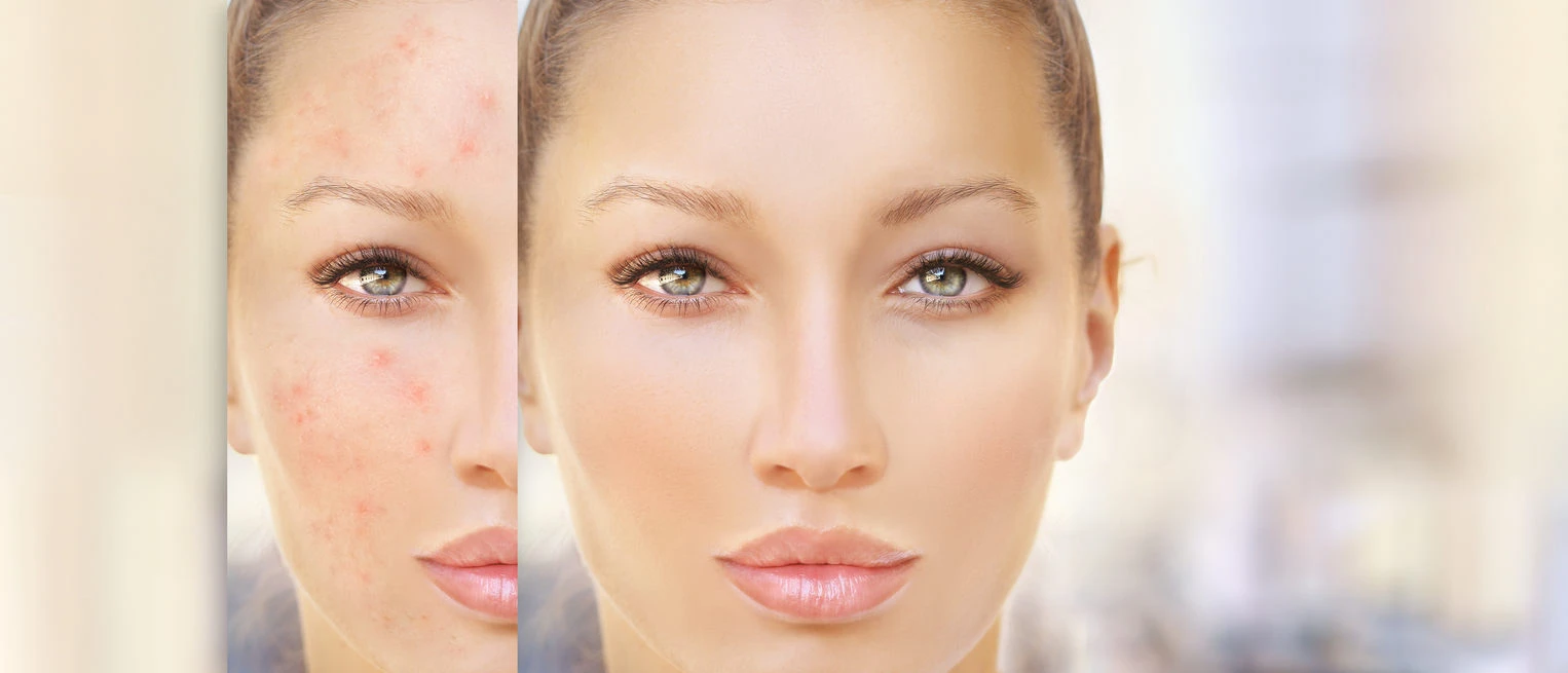Young woman with scars before and after