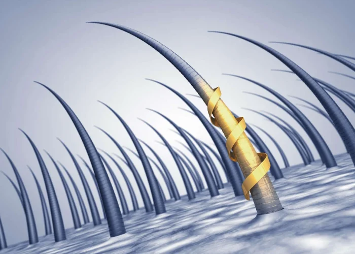 Stem Cell Hair Restoration